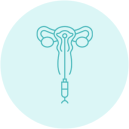 Inseminación intrauterina